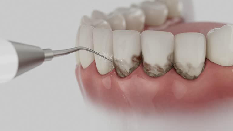 Trusted Emergency Dentist service in Huntingtown, MD - Dentist Open Now